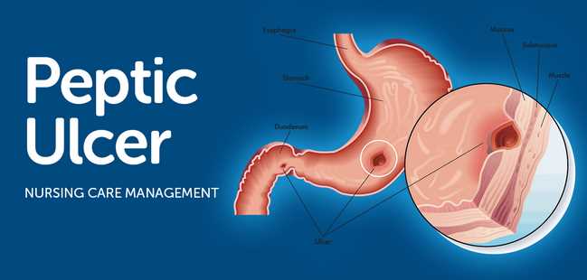 What is Peptic Ulcer Disease