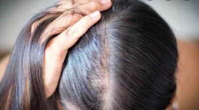 Can Hair Dye Cause Hair Loss