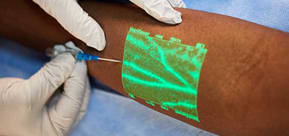 What is The Easiest Way to Find Veins