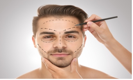 Top 5 Benefits of Facial Plastic Surgery