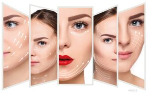 Understanding the Different Types of Surgical Facelifts