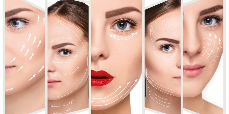 Understanding the Different Types of Surgical Facelifts